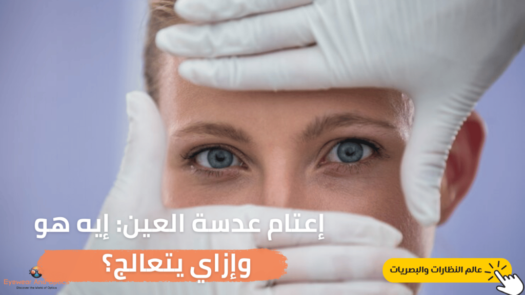 صورة توضيحية لإعتام عدسة العين، تُظهر كيف يؤثر إعتام العدسة على وضوح الرؤية ويعيق إدراك التفاصيل.